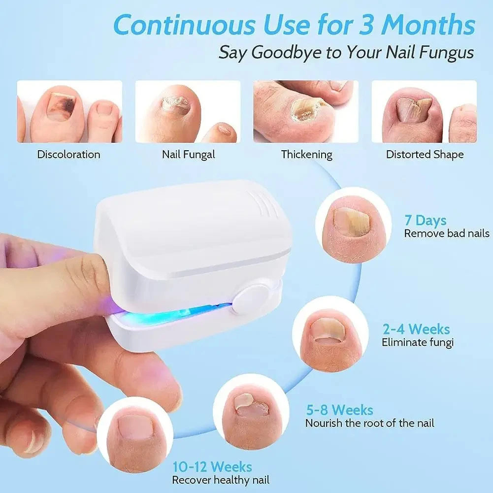 Nail Fungus Laser Treatment Device