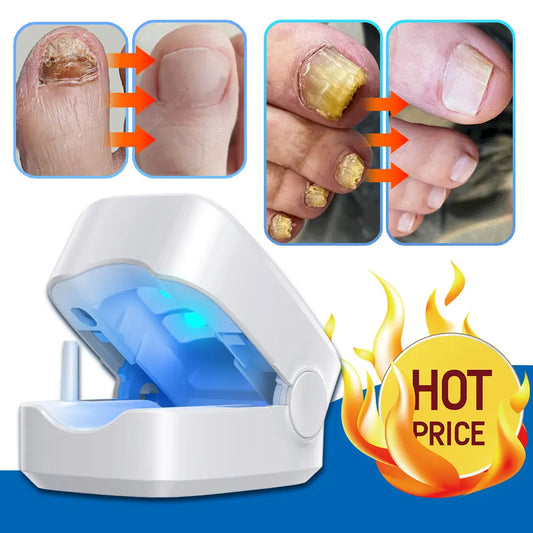 Nail Fungus Laser Treatment Device